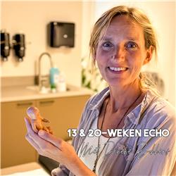 S6E7 - Alles over de 13- en de 20 weken echo met verloskundige & echoscopist Dineke Bokkers